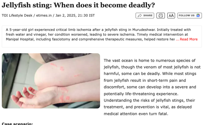 Manipal Hospital Yeshwanthpur: Dr. Harish Kumar K and Dr. Nanditha Rathinam on Jellyfish sting: When does it become deadly?